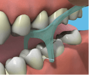 the plastic, single-use, greenish-blue thingy that has a handle with a U-shaped head and an inch-long piece of floss